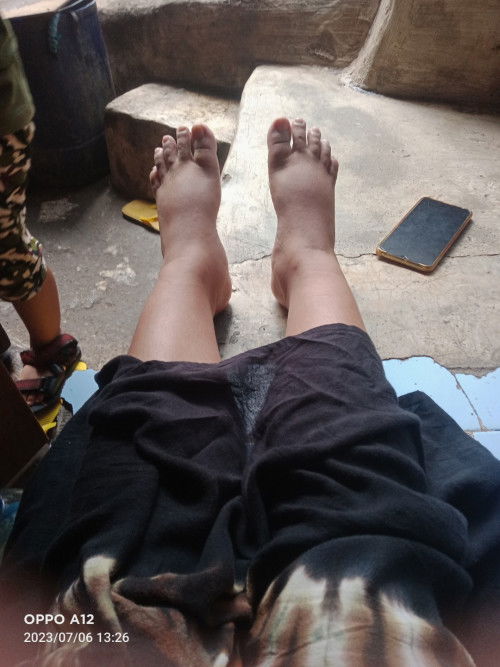 Ada Yang Sama Kah Hamil 22 Minggu Kaki Udah Bengkak😭