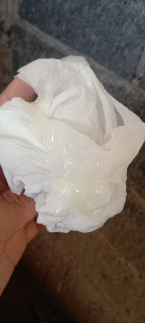 อายุครรภ์ได้ 28วีคแล้ว