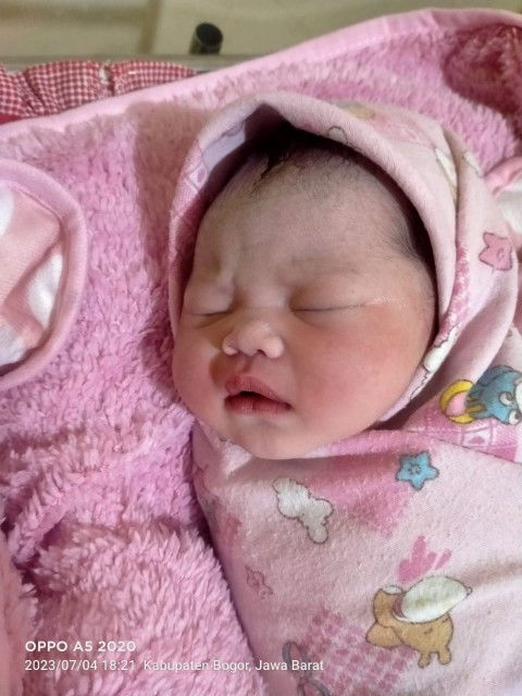 Alhamdullilah sudah lahir normal