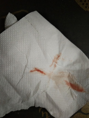 Implantation bleeding or Menstruation