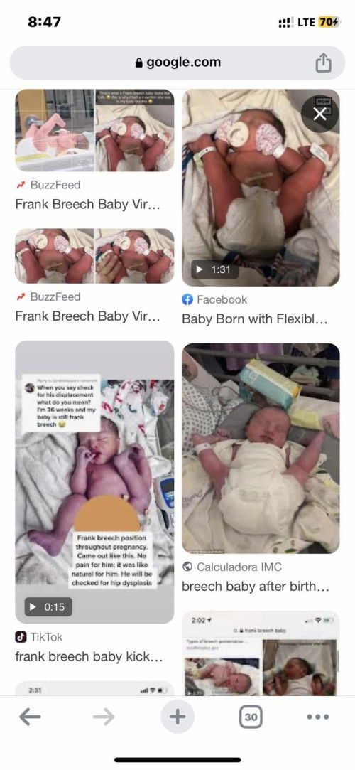 Frank Breech presentation