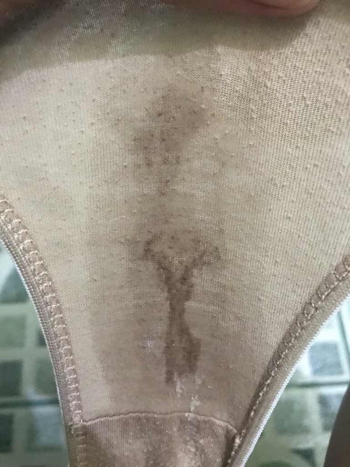 Malapit na po ba ako manganak mga mommy or sign of labor na po ba to?