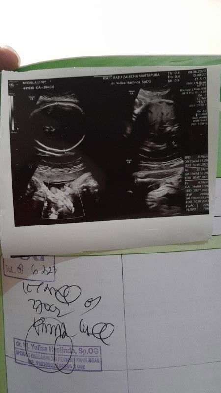 Bingung, bantu jawab yah bunda sharing pengalaman nya 🙏