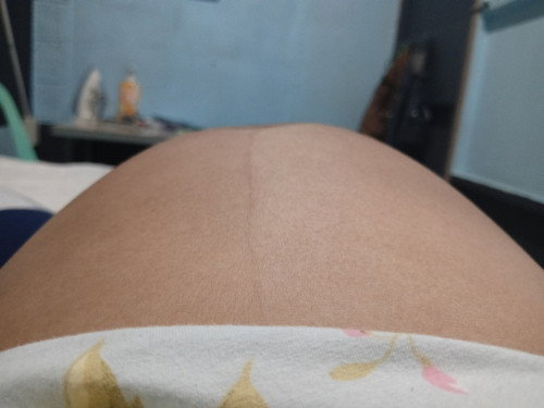 PANANAKIT NG PUSON,BALAKANG AT LIKOD