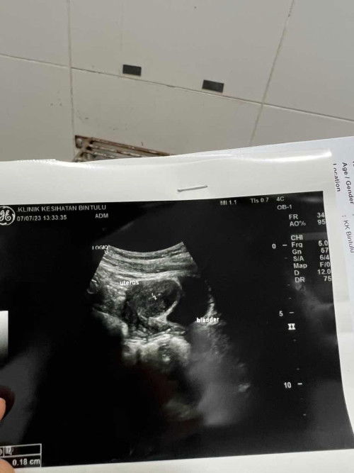 first mom . blurrrrr   , adakah okay mcm ni untuk awl pregnant ? minta pendapat ibu2 sekalian