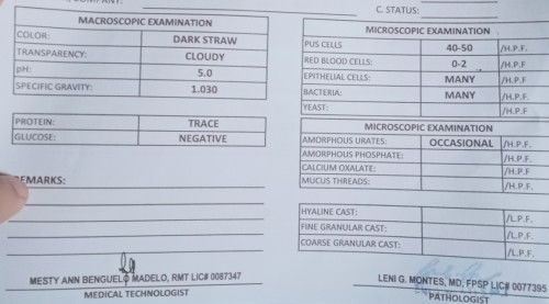 URINALYSIS RESULT