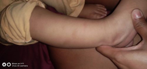 11 months old baby girl