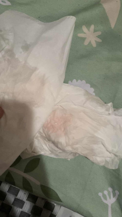 Air ketuban apa bukan ya?