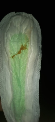 Mucus plug na po ba ito?