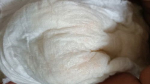 เเพมเพิสลูกมีเลือดจางๆตดอยู่