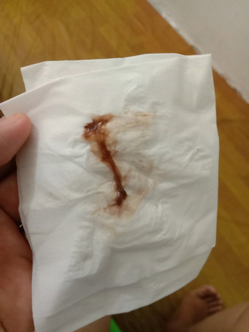 Keluar flek coklat