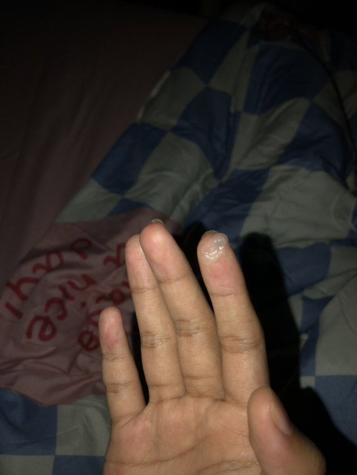 สอบถามแม่ๆหน่อยค่ะอันนี้คือมูกหรือเปล่าคะ