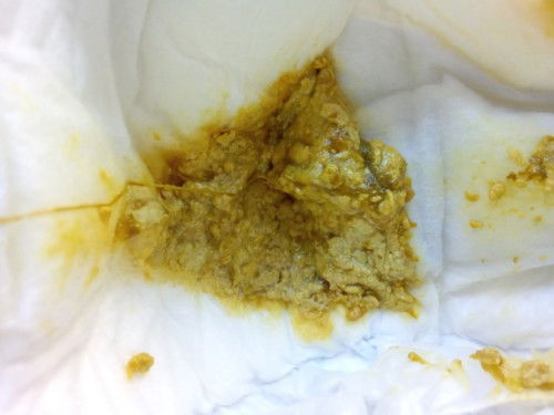 ขอคำปรึกษาหน่อยค่ะแม่ๆ