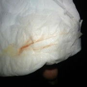 Hpl 6 juli udah keluar flek darah apa tanda mau lairan Bun. minta doa ya smgo dd sgr laucing ...amin