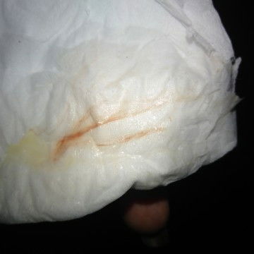 Hpl 6 juli udah keluar flek drah apa tanda mau lairan Bun .minta doa nya smg dd sgr laucing