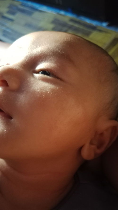 Ini kenapa ya bun, kering mengelupas, dan merah,