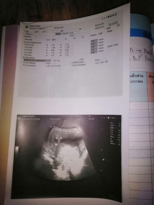 ขอดูรูปอัลตร้าซาวของแม่ ๆหน่อยจร้า