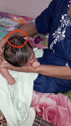 Bun mau tnya yg lahir normal kya sya , udh 1 bln anak sya panjul sprti d fto , kira2 bsa brbh d usia