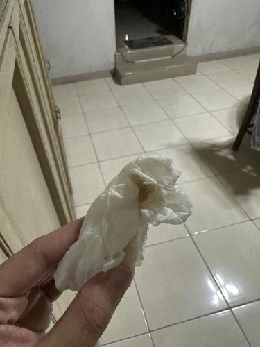 Mga Mii. Mucus Plug?
1cm nung Thursday.. now Sat kaya ilan cm na usually pag may lumabas na ganito?