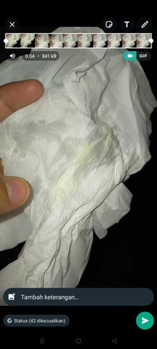 Bun mau tanya uk 38 week ngeluarin kaya gni apakah ini tnda saya mau lahiran