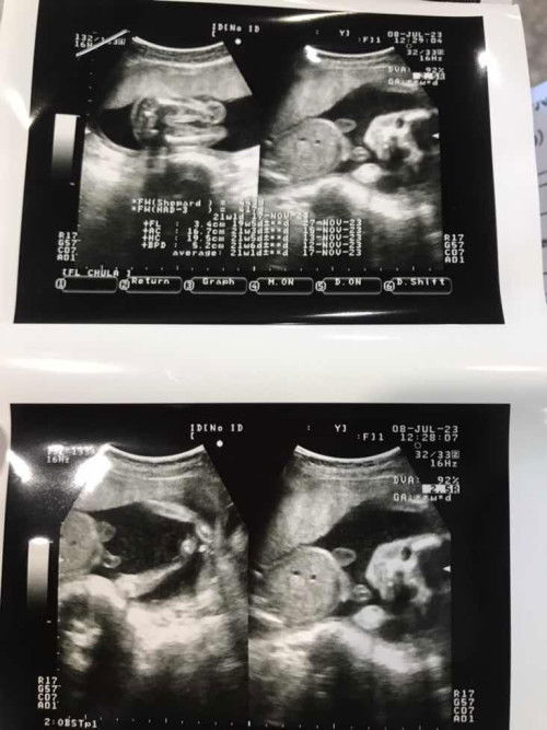 21weeks 1day👶🏻🤍