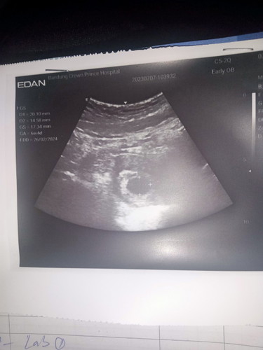 แม่ๆเจอตัวเด็กตอนกี่สัปดาห์คะ