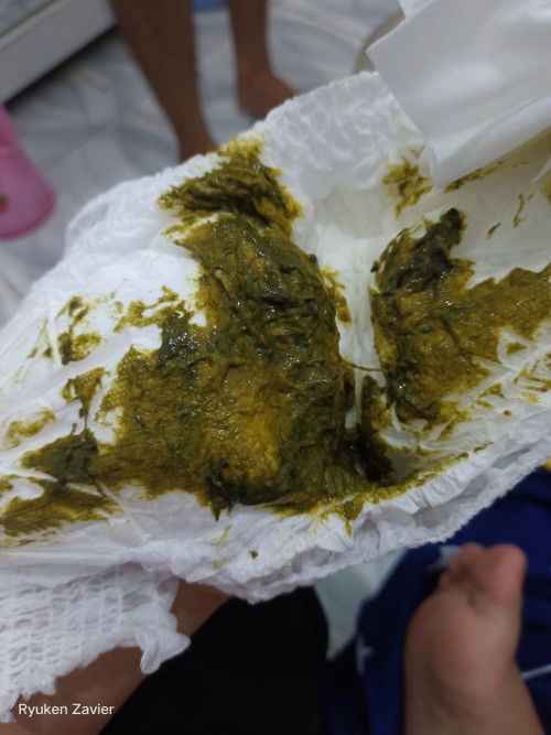 Pup bayi 2 bulan susu sufor