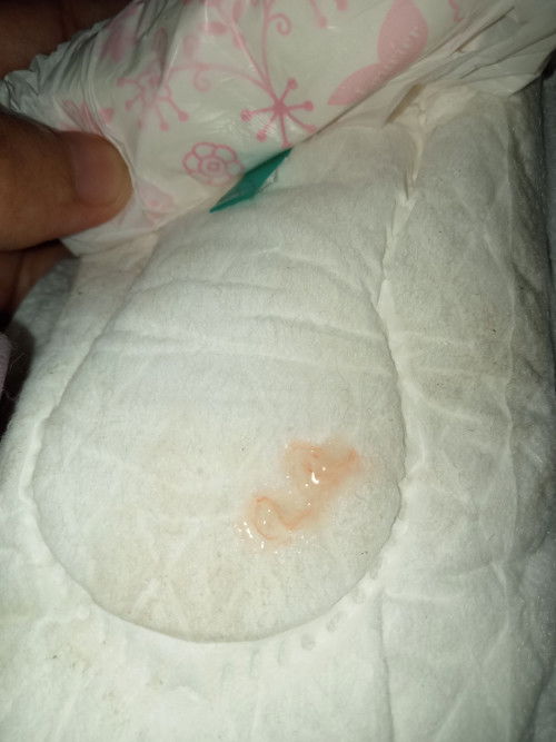 Hpl 22 juli, ga ada kontraksi tapi keluar lendir ping