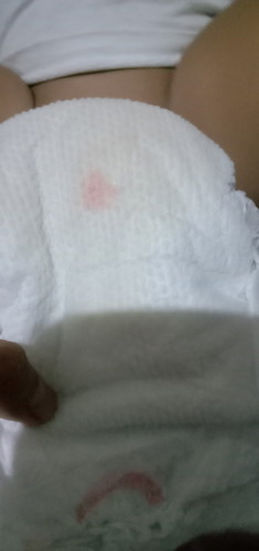 red stain sa diaper