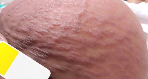 Ask ko lang po mga mommys.