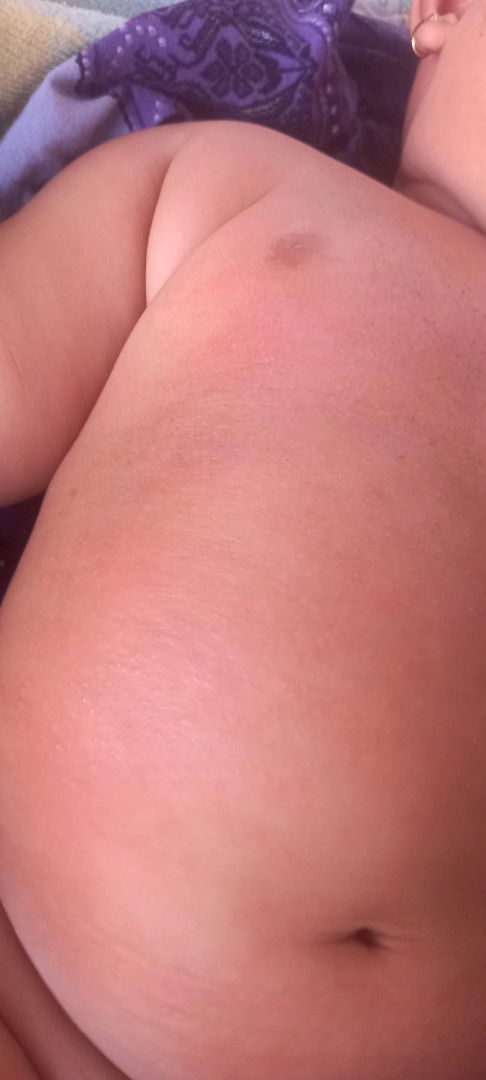 Ini di kasih apa yaa  gatal² bayi 6 bulan