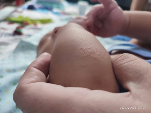 Skin rash?