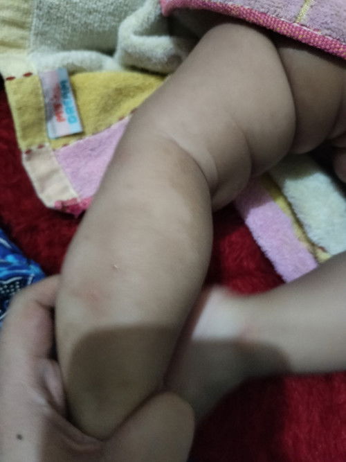 Cara menghilangkan daki anak