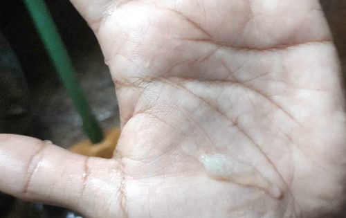 คุณแม่ไหนบ้างออกสีขาว ใช้ตกขาวหรืออะไรคะ 38+5 วีค