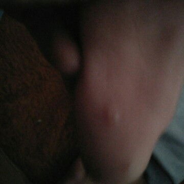 Mau tanya bund , ini knapa ya , dan isinya ber air