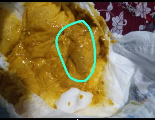 Pup bayi sering berlendir