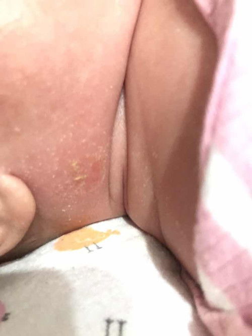 ผิวที่คอเป็นแบบนี้คืออะไร