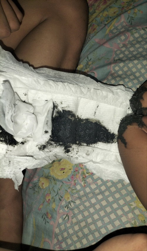 Feses bayi 7 bulan abu abu gelap