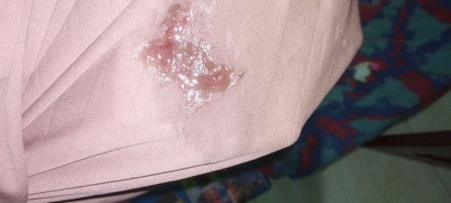 Lendir darah di usia kehamilan 40 week