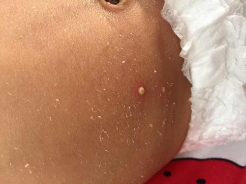 น้องอายุ13วัน