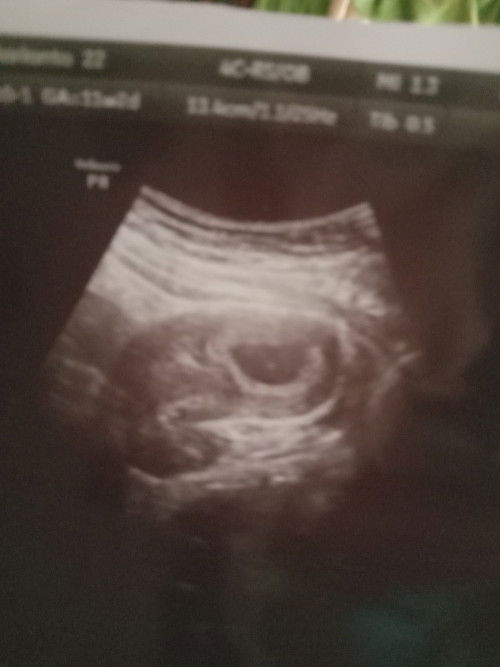 Bunda ada yg seperti saya gak ..