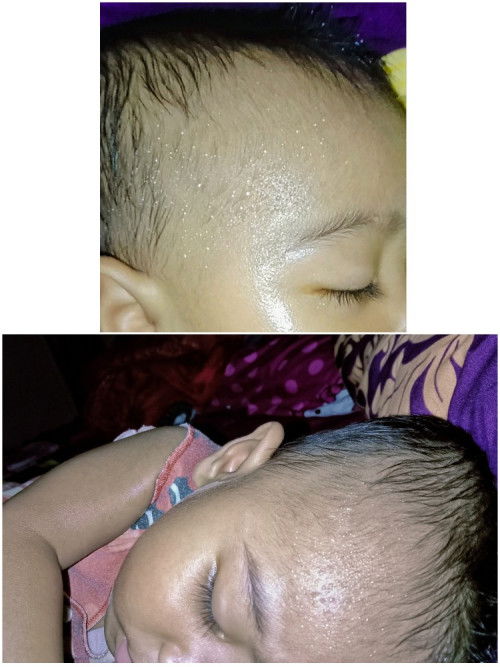 Bayi 8 bulan keringatan dan bb tidak ideal