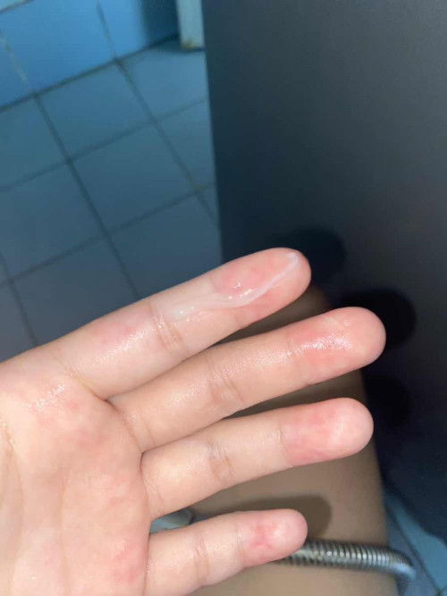 37+4w กำหนดคลอด27