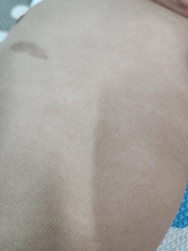 Kulit bayi berbiji kasar
