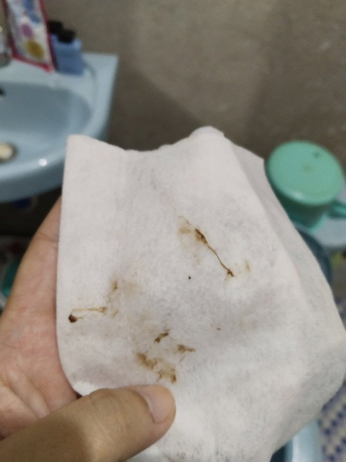 Bloody show?
38weeks6days