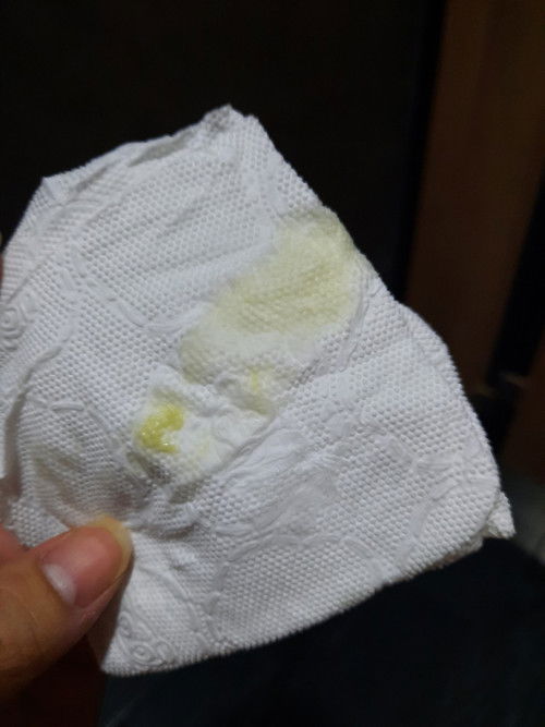 ขอสอบถามค่ะ