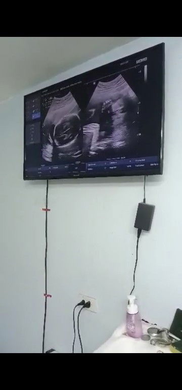 แม่ช่วยดูหน่อยว่าน้องผู้หญิงหรือผู้ชาย