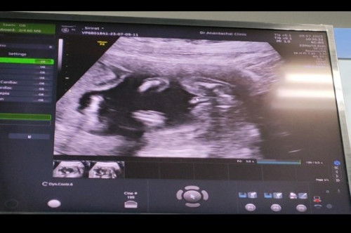 แบบนี้ใช่จู๋น้อยๆมั้ยค่ะ