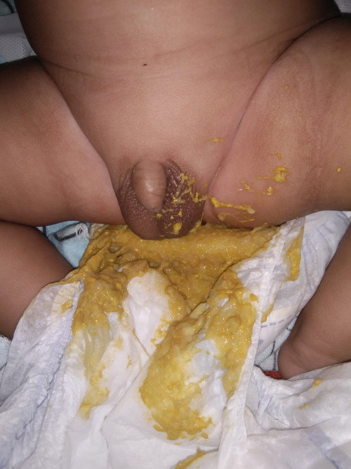 Poop ni baby