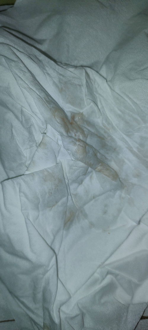 keluar cairan berwarna cokelat seperti darah